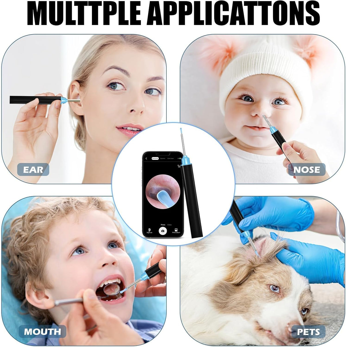Earwax Remover Tool with 18 Pcs Set IOS/Android